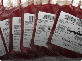 Đã có thêm những căn bệnh lạ làm đau đầu giới y học hiện đại ngày nay, thách thức nền y học